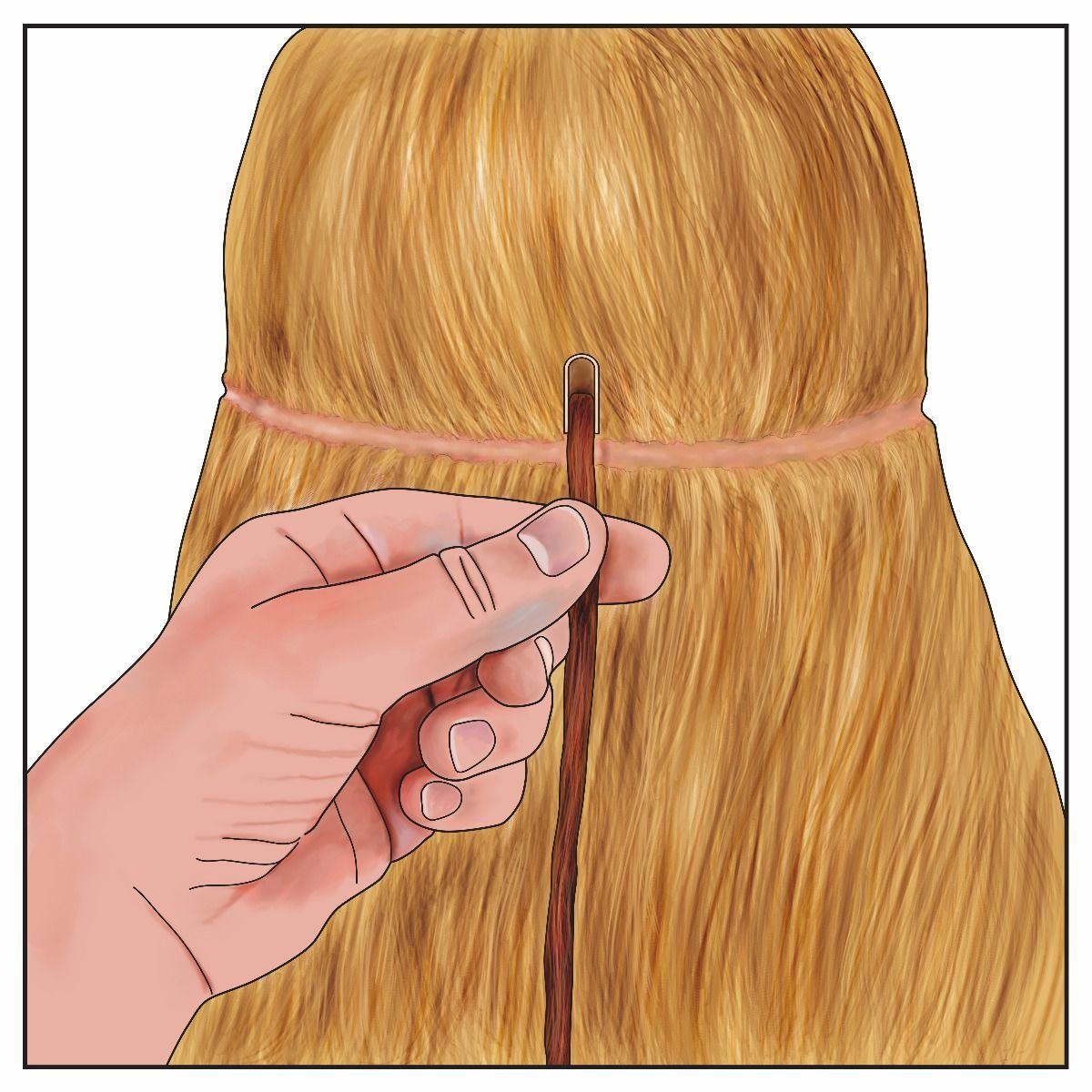 Fitting Guide for Bonding Extensions
